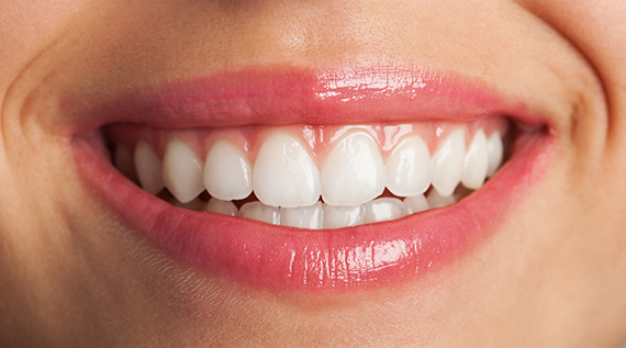 Cosmetic Dentistry at Global Dental Group, Mission Viejo